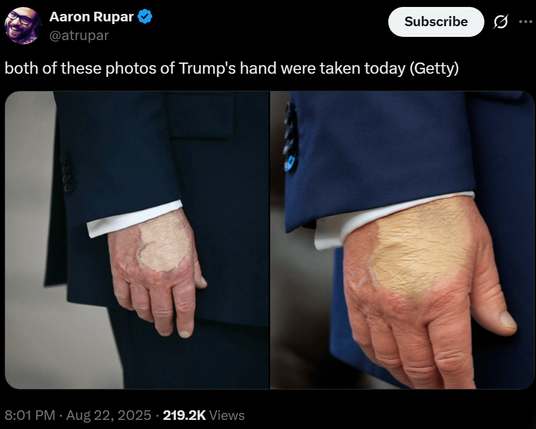 Are they gold leafing Trump's wounds now?