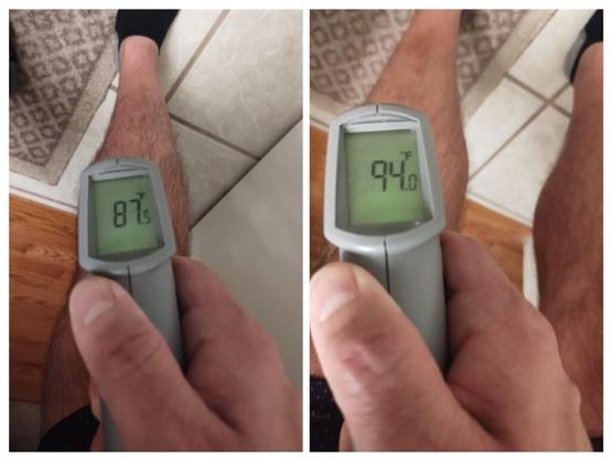 The temp difference between my normal shin and the one that was stung by a wasp today. Body is doing it's thing.