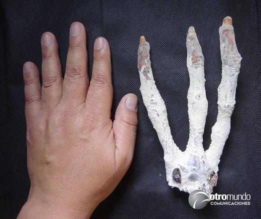 The difference between a human hand and a tridactyl hand