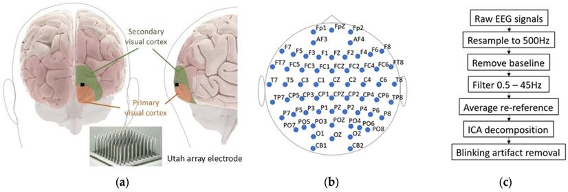 Experimental setup. (a) Approximate region where UEA was implanted in both subjects. (b) Location of EEG recording electrodes. Notably, Fp1 position was omitted from analyses due to high levels of noise and artifacts found in signal during recordings. (c) Pipeline used for removing blink artifacts.