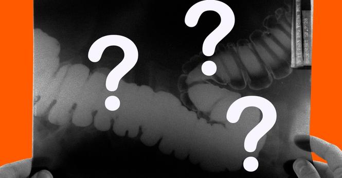 An image of an abdominal x-ray with question marks surrounding it.